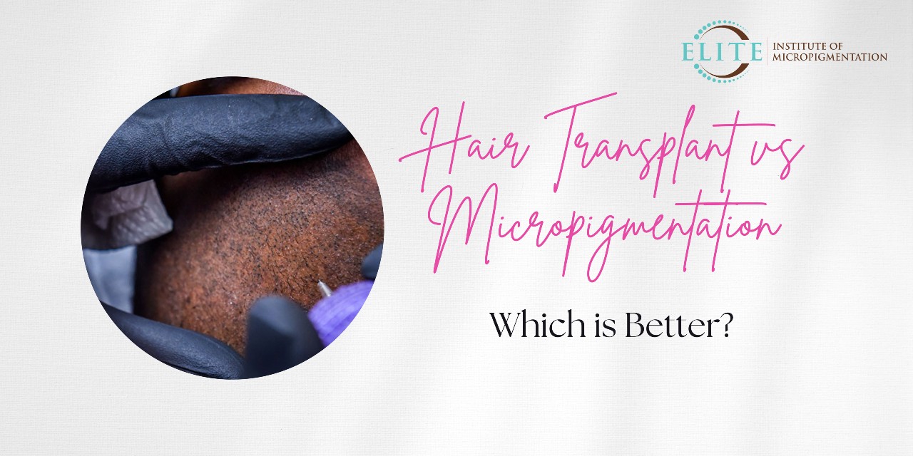 Hair Transplant vs Micropigmentation