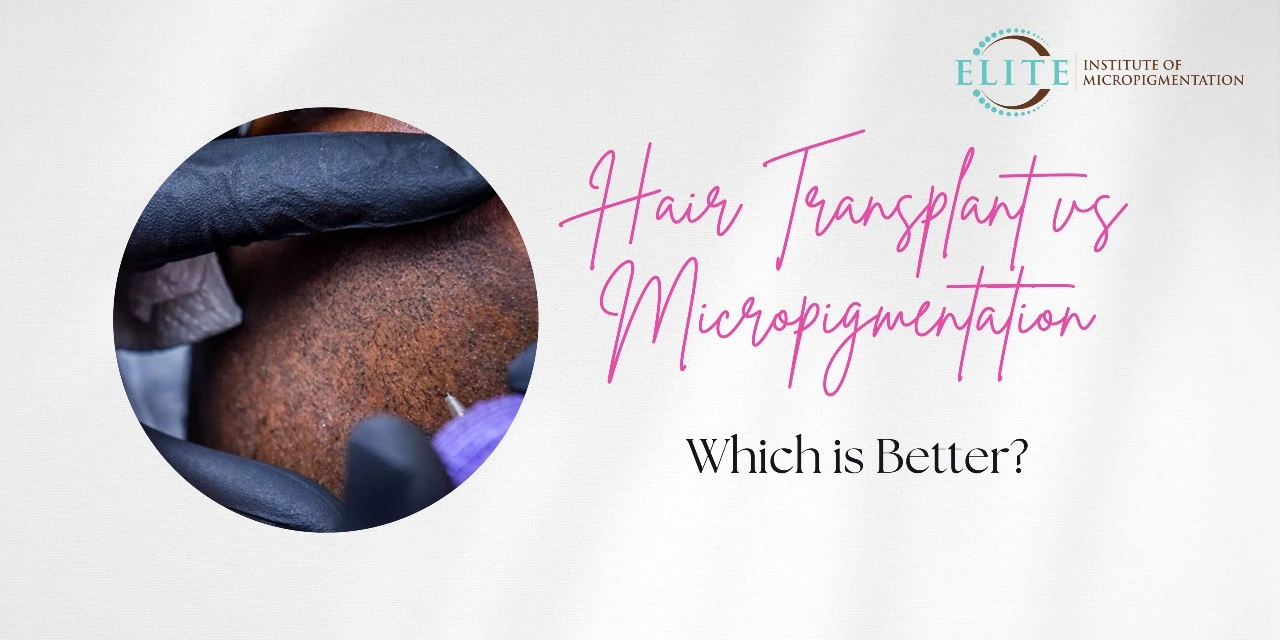 Hair Transplant vs Micropigmentation - Which is Better?