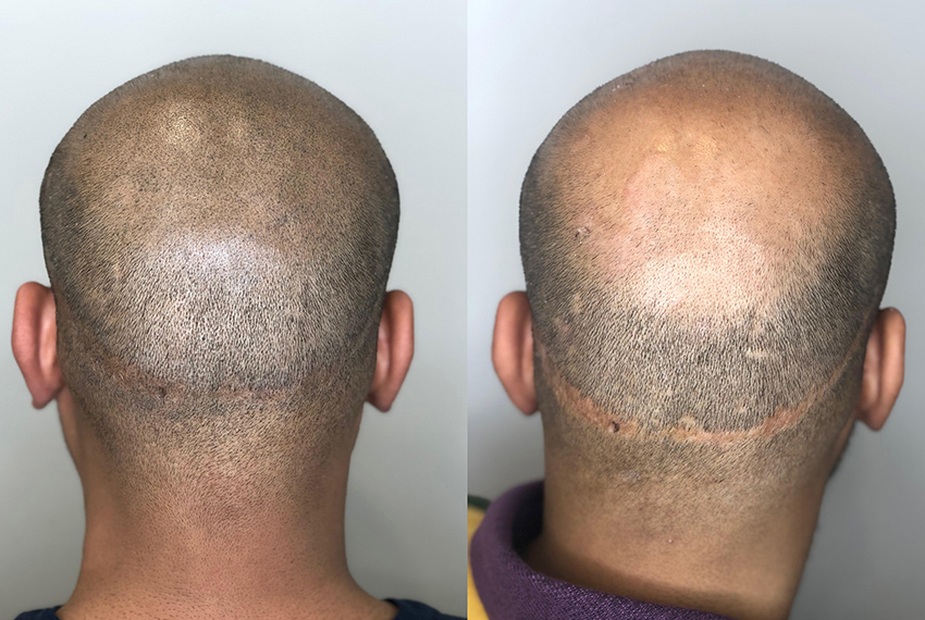 microbladed 3D Hair Stroke technique
