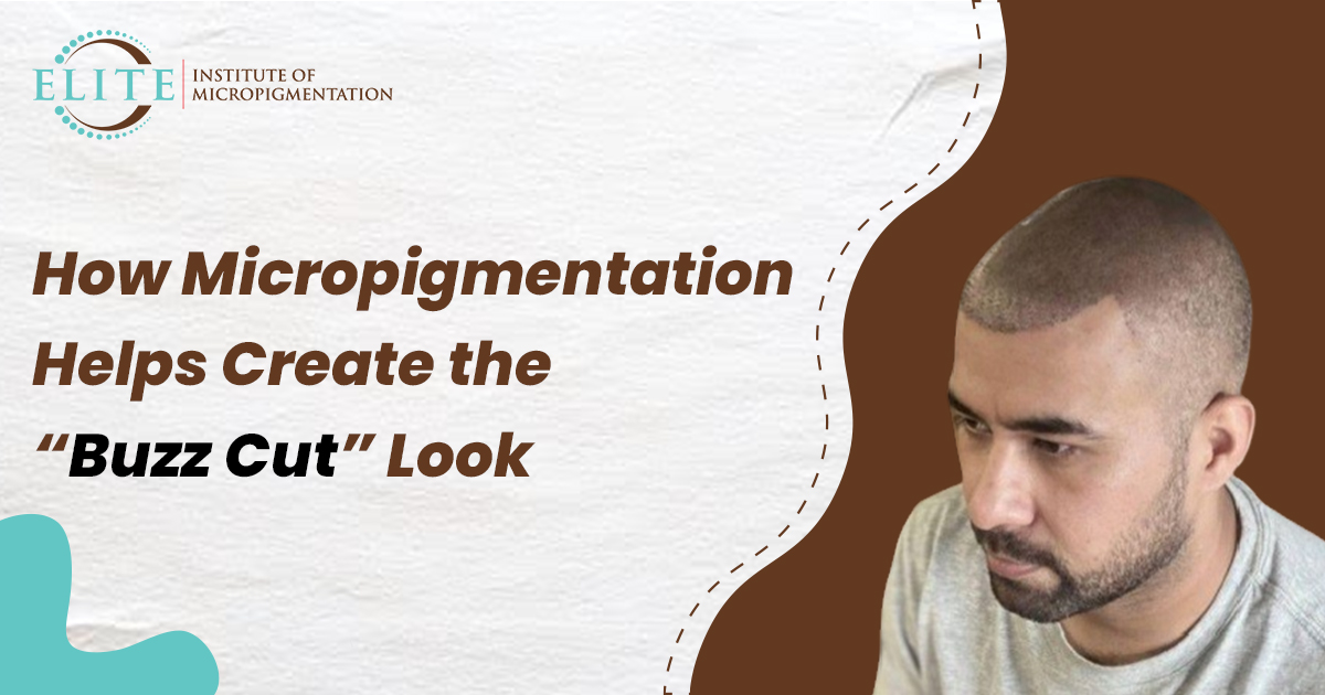 scalp-micropigmentation-after-hair-transplant-a-comprehensive-guid