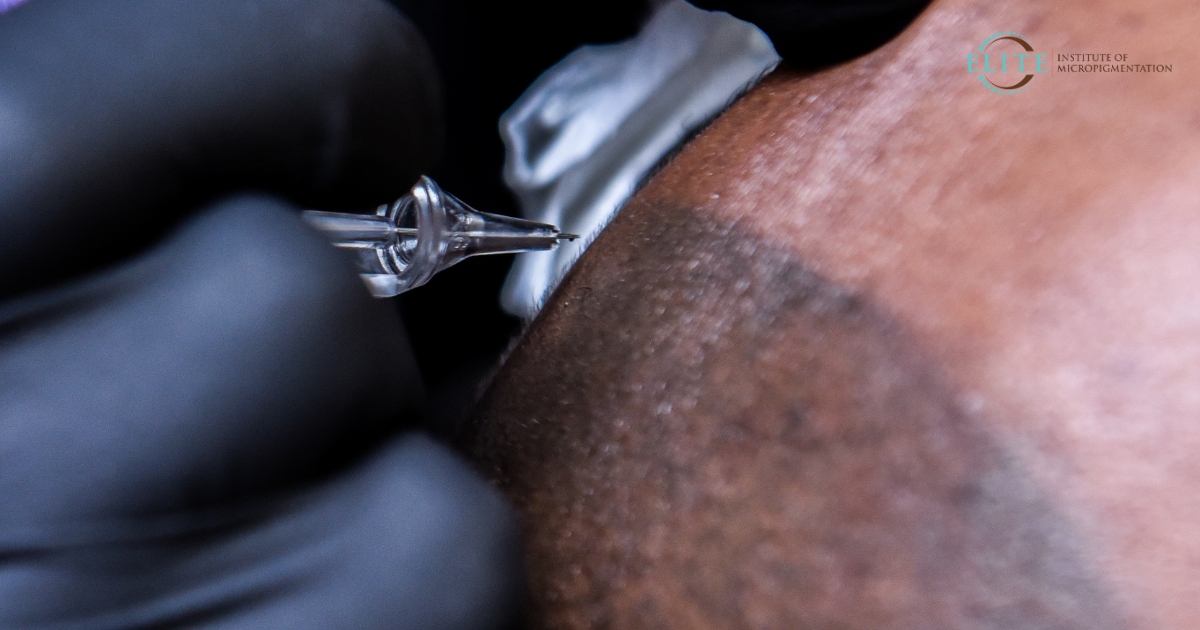 scalp-micropigmentation