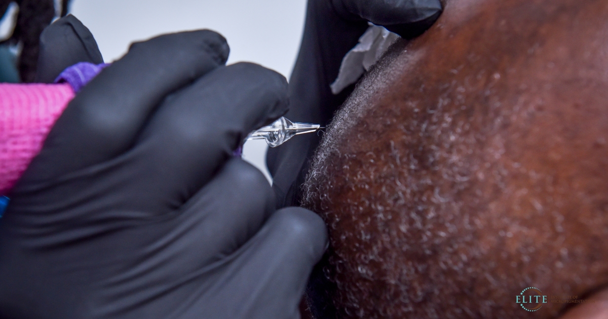 scalp-micropigmentation